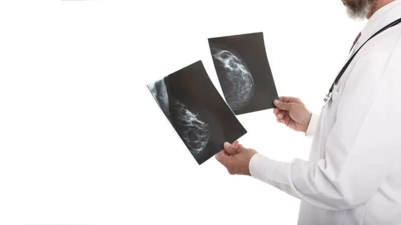 3D Mammography