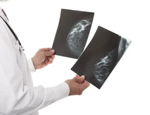 3D Mammography: What You Need to Know